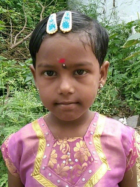 World Vision India